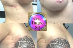 tatouage-cicatrices-sein